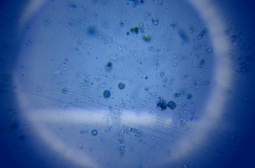 acqua-contaminata-rischi